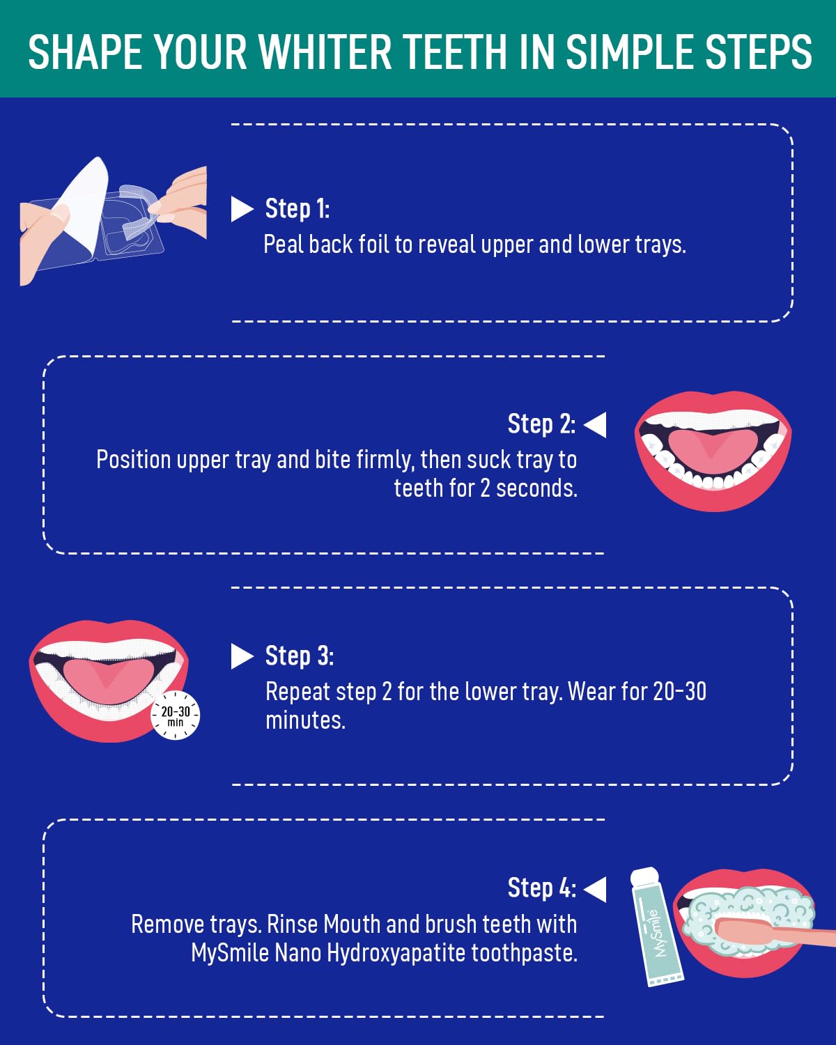 MySmile 7-Day Teeth Whitening Bundle - 12% Hydrogen Peroxide Trays + Fluoride-Free Nano Hydroxyapatite Toothpaste