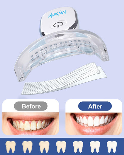 MySmile Teeth Whitening Strips Kit – 14 Treatments, 28 LED, Fast Whitening