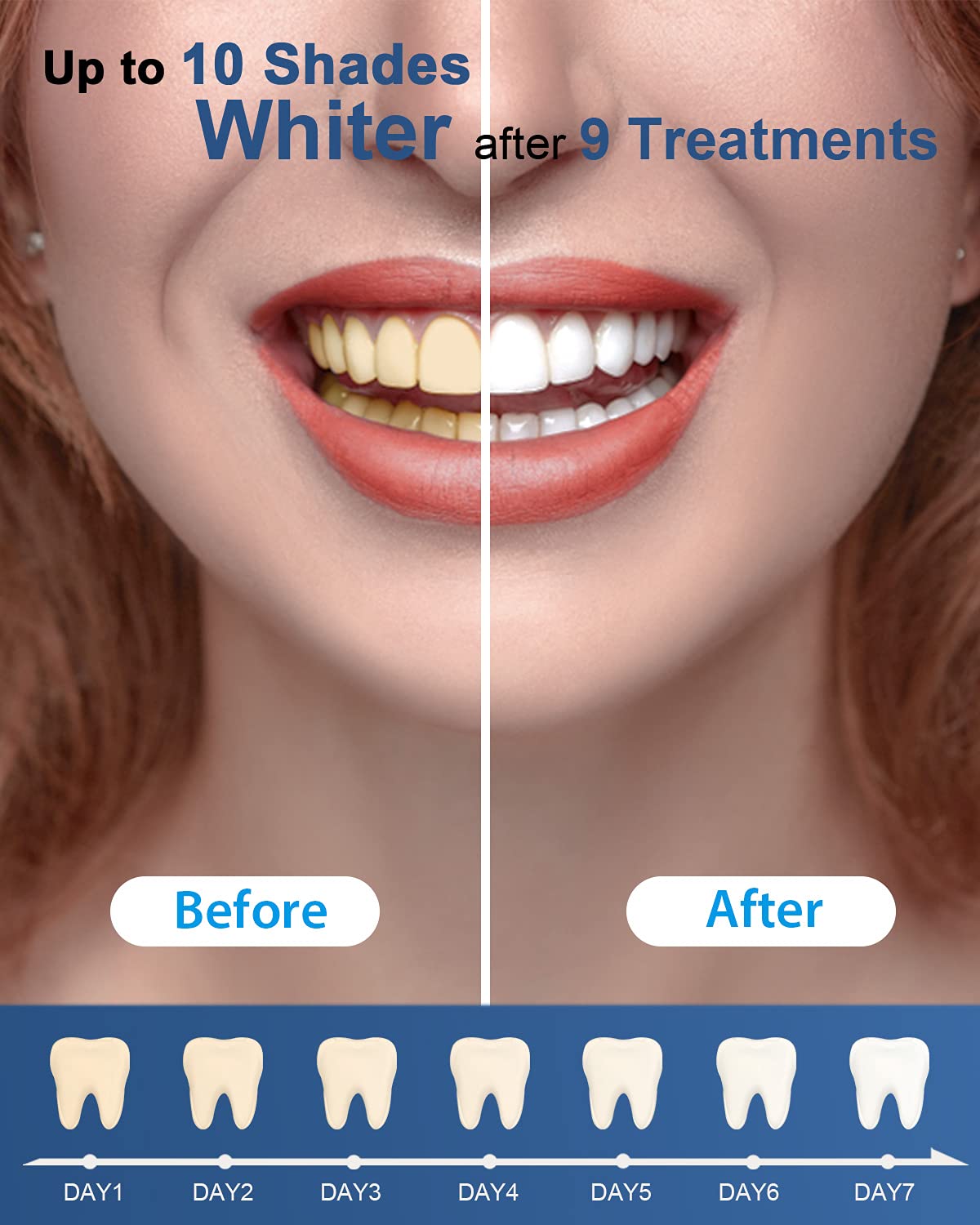 MySmile Teeth Whitening Gel Pen Refill Pack – 3 Non-Sensitive Pens, Deluxe Home Whitening, 10-Min Results
