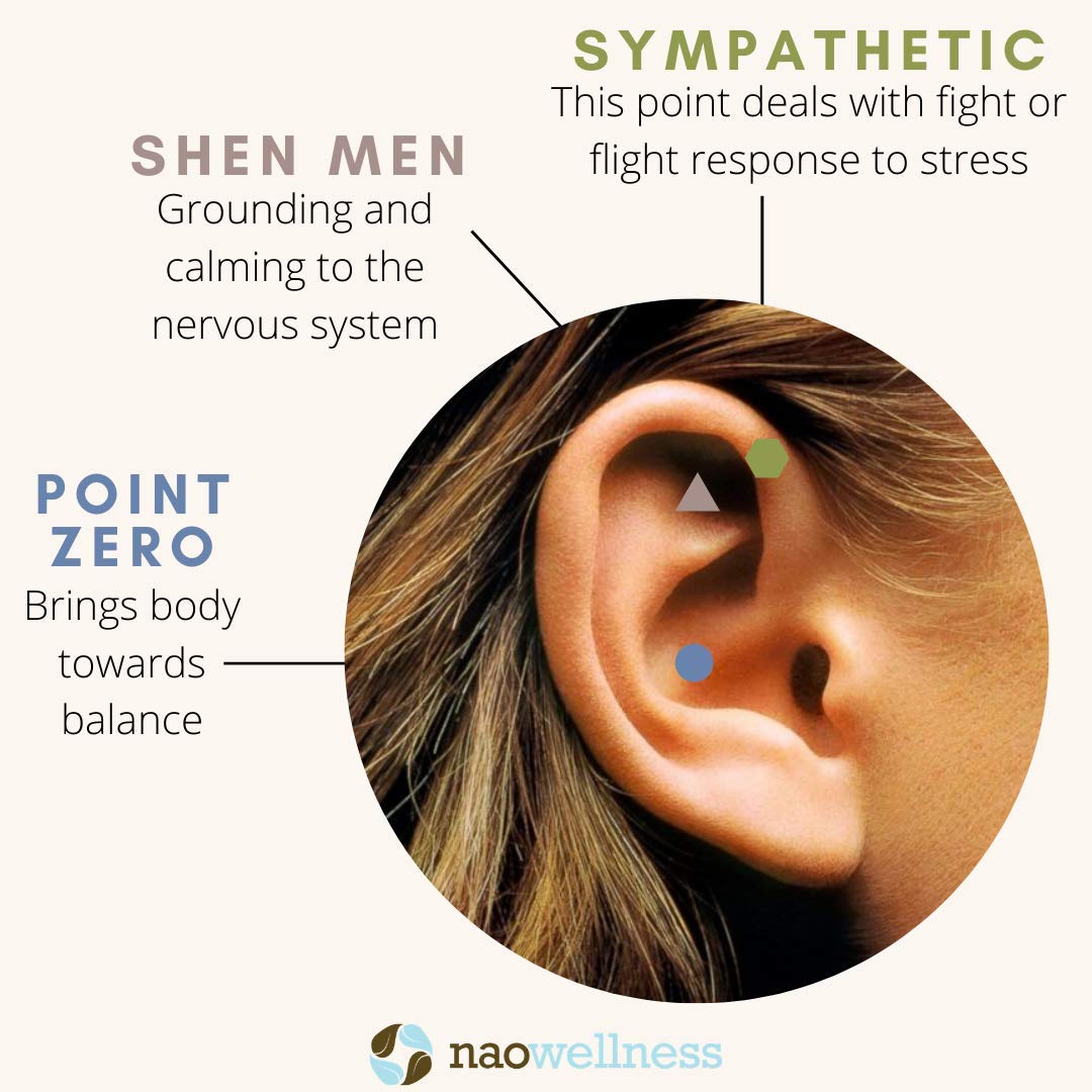 NAO Wellness 24K Gold Ear Seeds – Auriculotherapy Kit (20 Seeds) for Adults & Kids | 40+ Solutions