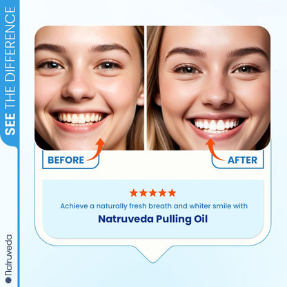 Natruveda Coconut Oil Pulling Mouthwash – Natural Whitening Ayurvedic Rinse | Fresh Mint Blend | Coconut Oil Pulling for Teeth & Gums | Whyte Oil Pulling | 10 oz