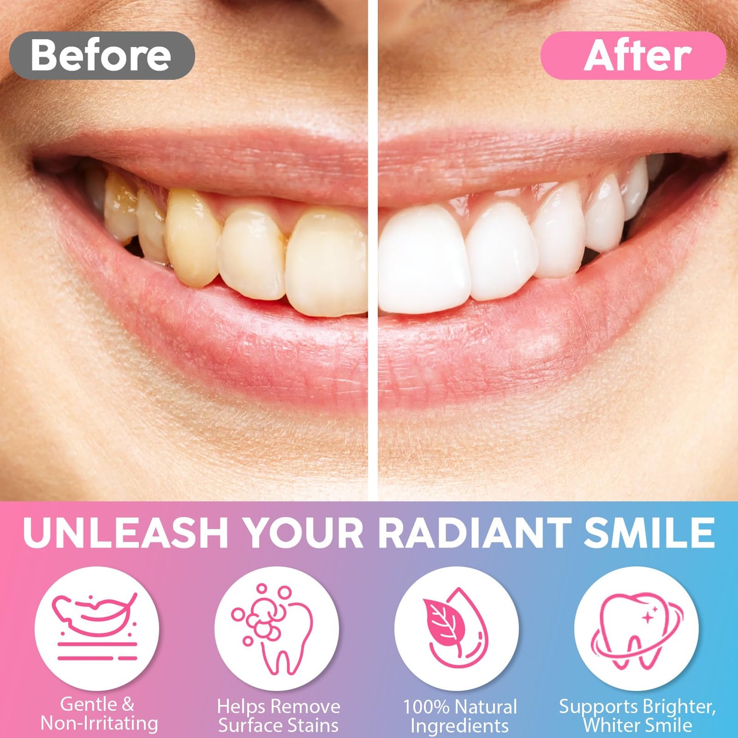 2 Pcs Niacinamide Whitening Toothpaste - Enamel Protection, Fluoride-Free, For Sensitive Teeth