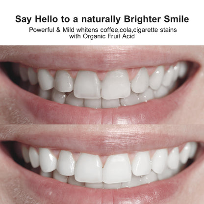 Nobaton 1% Fruit Acid Whitening Ampoule Toothpaste with Nano HAP – Enamel-Safe Brightening (3 Bottles, 1.23 oz Each)