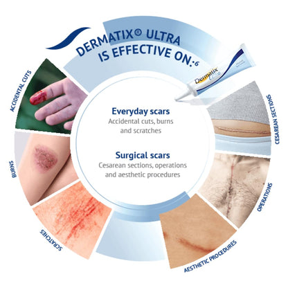 NOUVOS Dermatix Ultra Scar Gel - 15g | Softens and Flattens Scars, Quick-Drying, Odorless