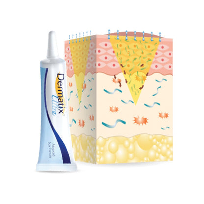 NOUVOS Dermatix Ultra Scar Gel - 15g | Softens and Flattens Scars, Quick-Drying, Odorless