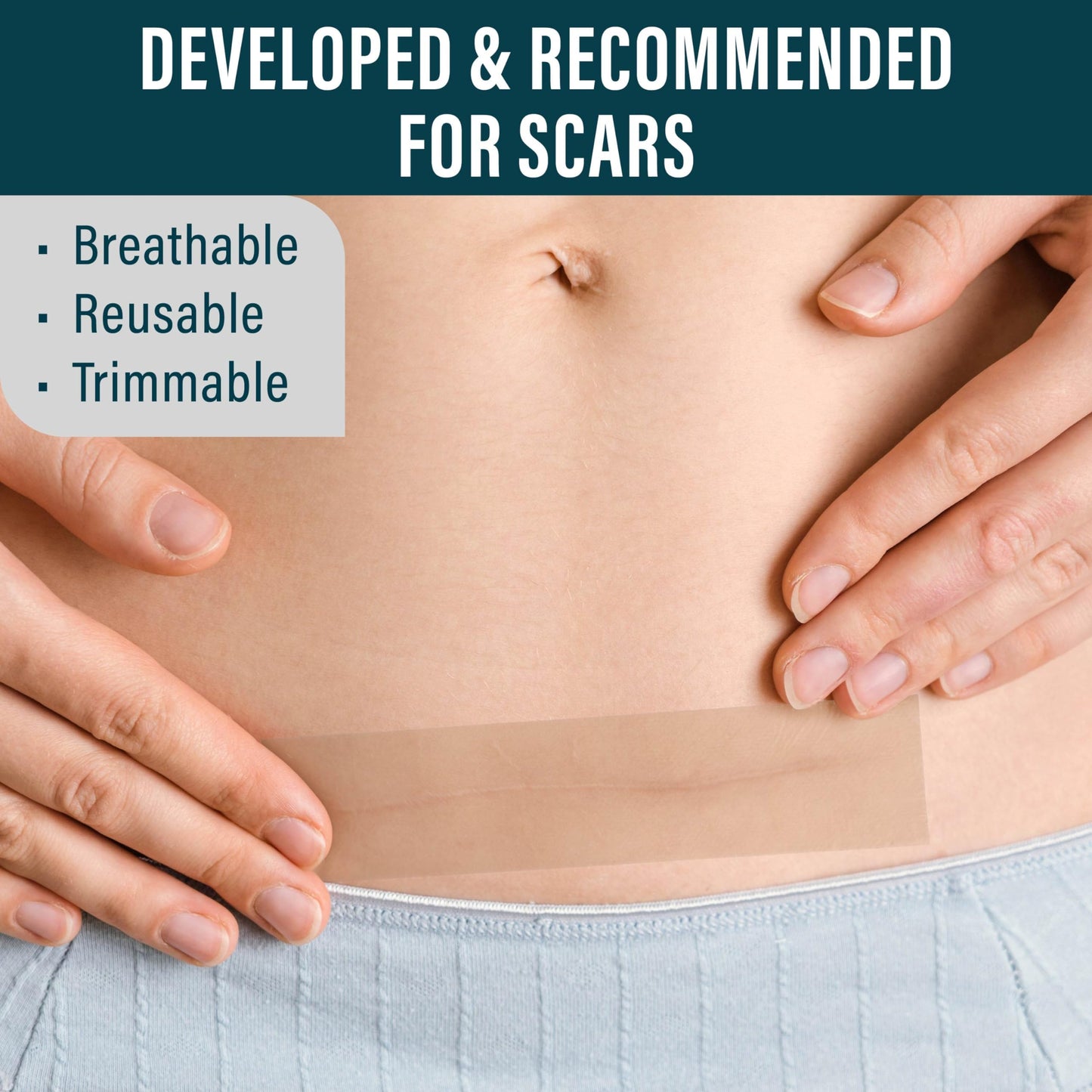 NUVADERMIS Silicone Scar Sheets - 120x1-5 Roll - Medical-Grade Scar Tape for Surgical Scars Wrinkles and Keloids