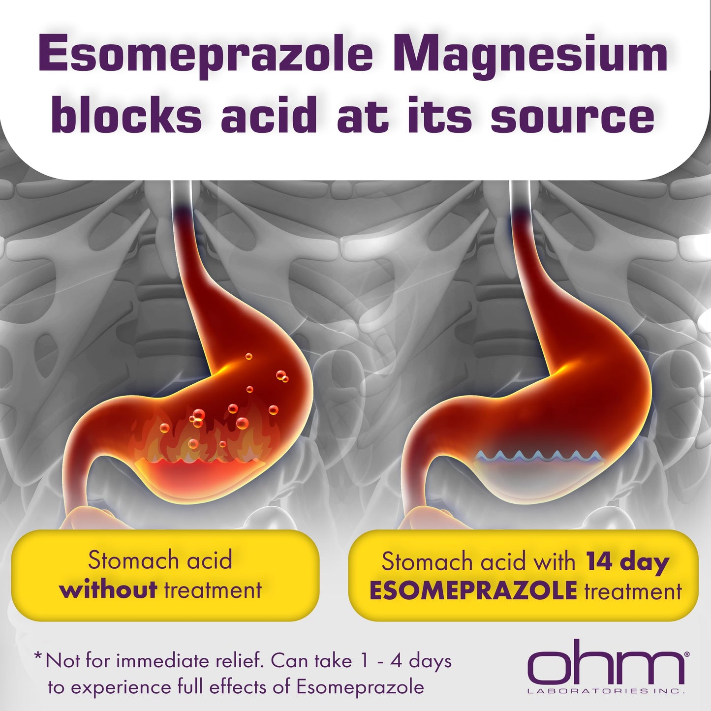 Ohm Esomeprazole 20mg Delayed-Release Capsules — 24-Hour Heartburn Relief (42 ct)
