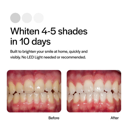 Opalescence Go 15% Mint — Prefilled Teeth Whitening Trays (4 Treatments per Pack, 3 Packs) | Ultradent