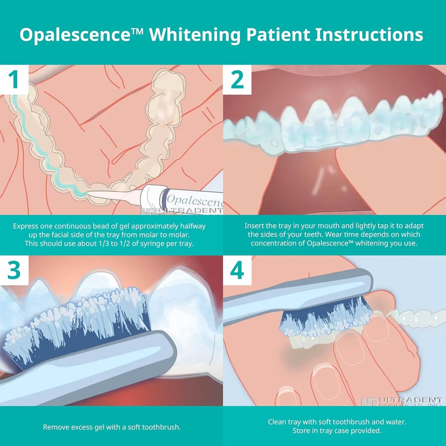 Opalescence 35% CP Mint Gel Syringes Refill Kit (4 Syringes) – Ultradent 5197-2tb