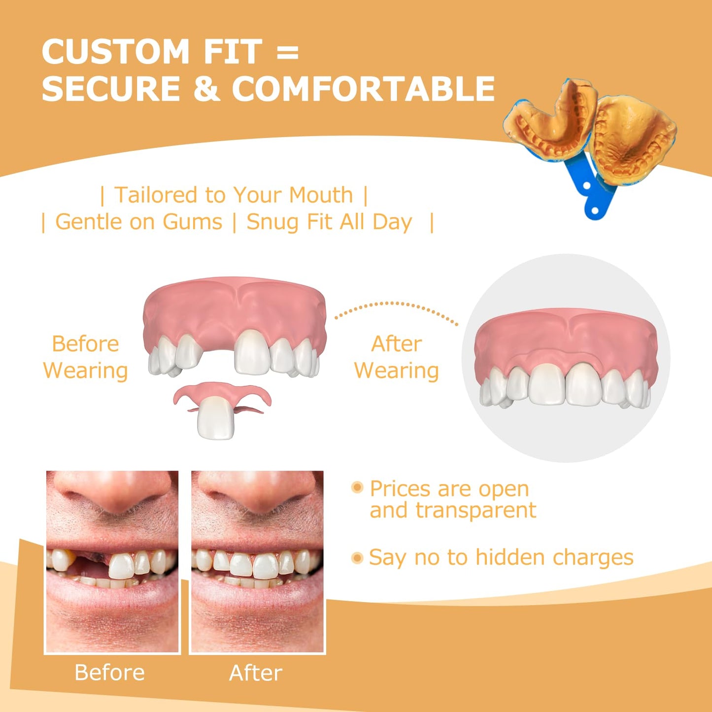 Partial Dentures - Lightweight, Unbreakable Replacement Teeth (5 Teeth) for Missing Teeth | Men & Women