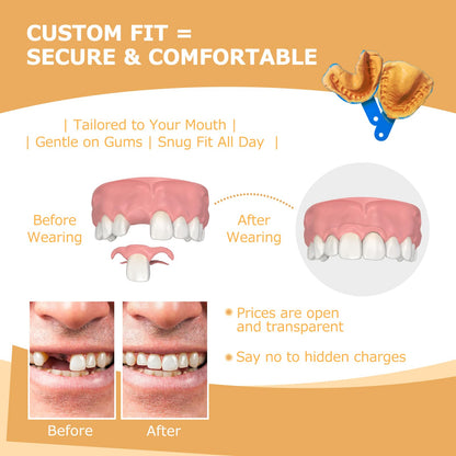 Partial Dentures for Missing Teeth & Gaps — Lightweight, Unbreakable Replacement Teeth (1 Tooth)
