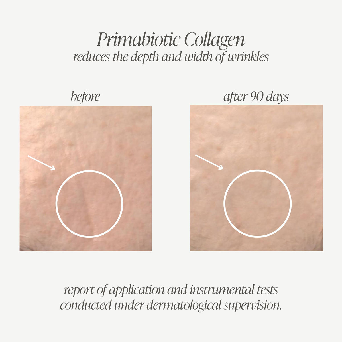 PRIMABIOTIC Liquid Collagen – 10,000 mg per Serving, Hydrolyzed Collagen + 12 Vitamins, Gluten Free, 900 ml (30 x 30 ml)
