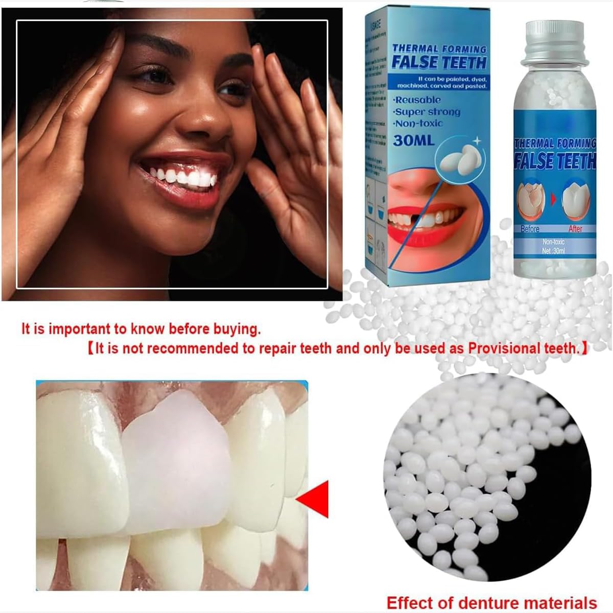 Provisional Tooth Repair Kit - Provisional Replacement Dentures DIY Heat Fit Beads (30ml, 2 Bottles) | Yuehao Beauty Supplies