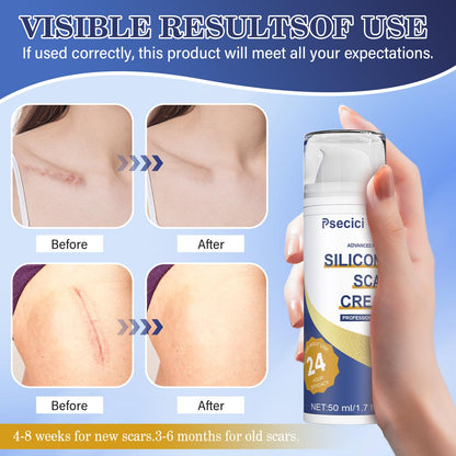 Psecici Silicone Scar Gel – Advanced Scar Cream (1.7 oz) for Surgical & Acne Scars
