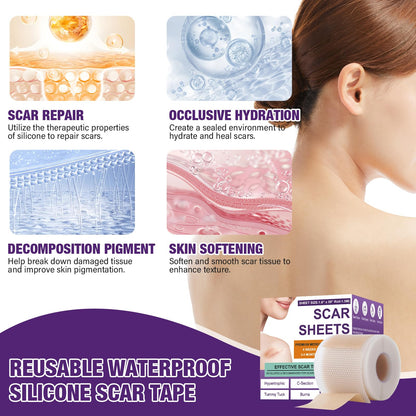 Psecici Silicone Scar Sheets Roll 1.6x120 – Medical-Grade Scar Tape for Surgical, C-Section, and Keloids