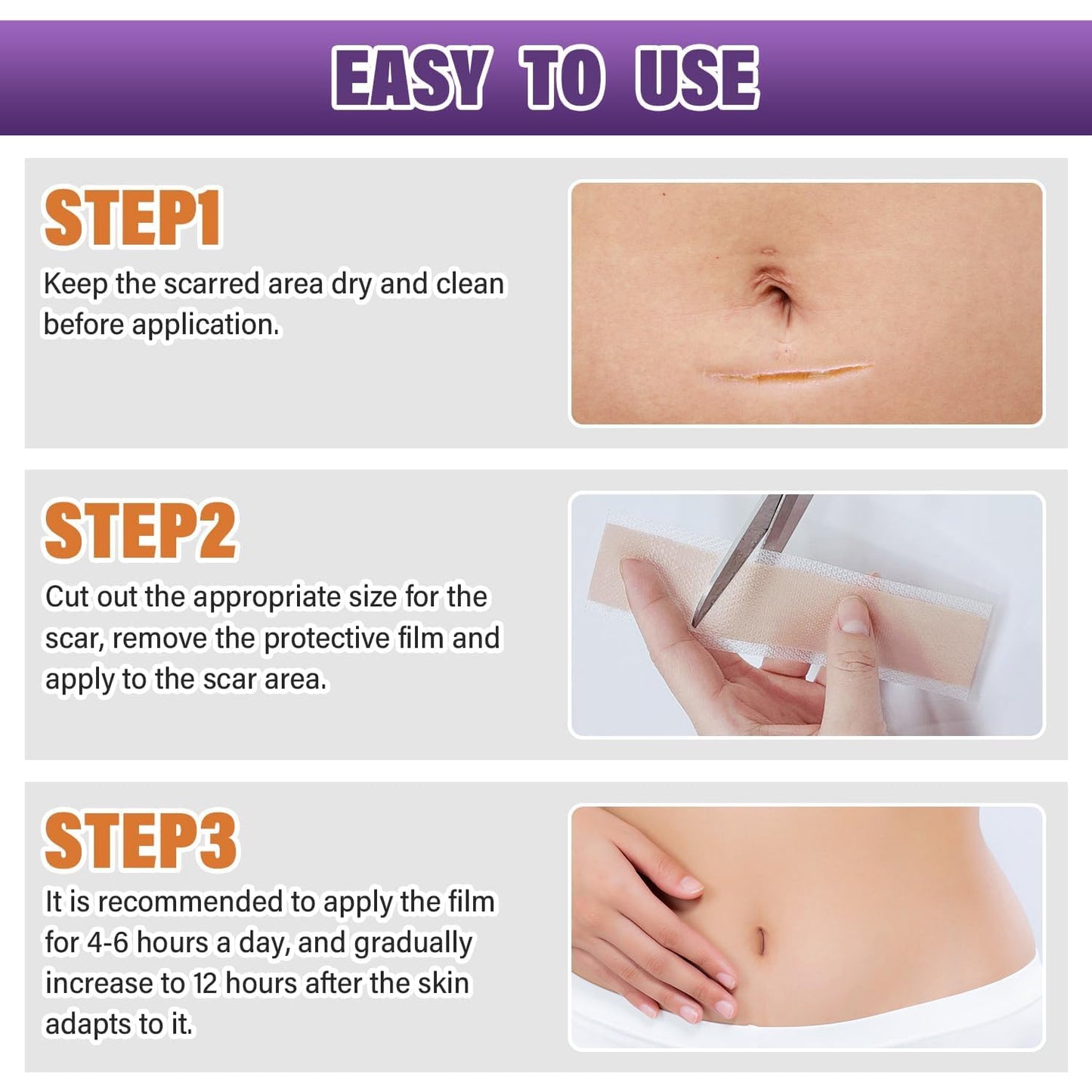 Psecici Silicone Scar Sheets Roll 1.6x120 – Medical-Grade Scar Tape for Surgical, C-Section, and Keloids