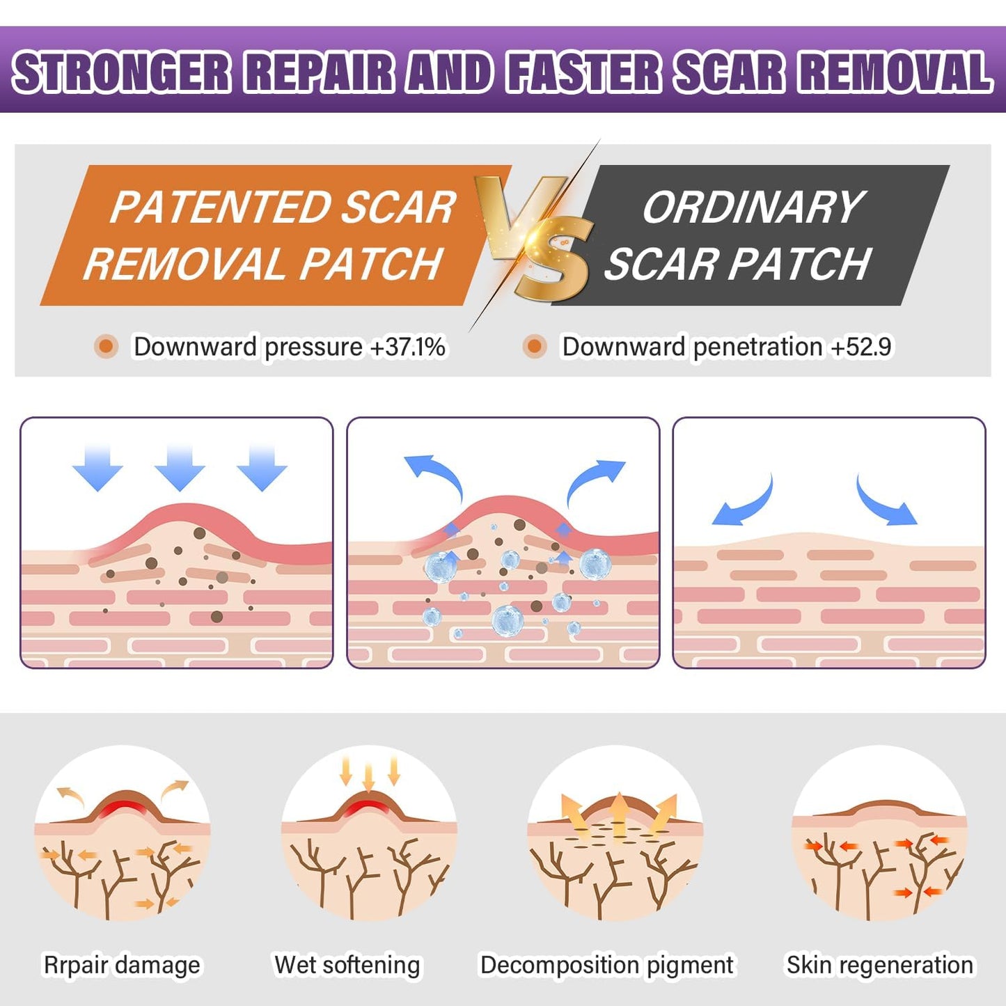 Psecici Silicone Scar Sheets & Tape – Medical-Grade, Reusable Scar Strips (1.6 x 59 in Roll)