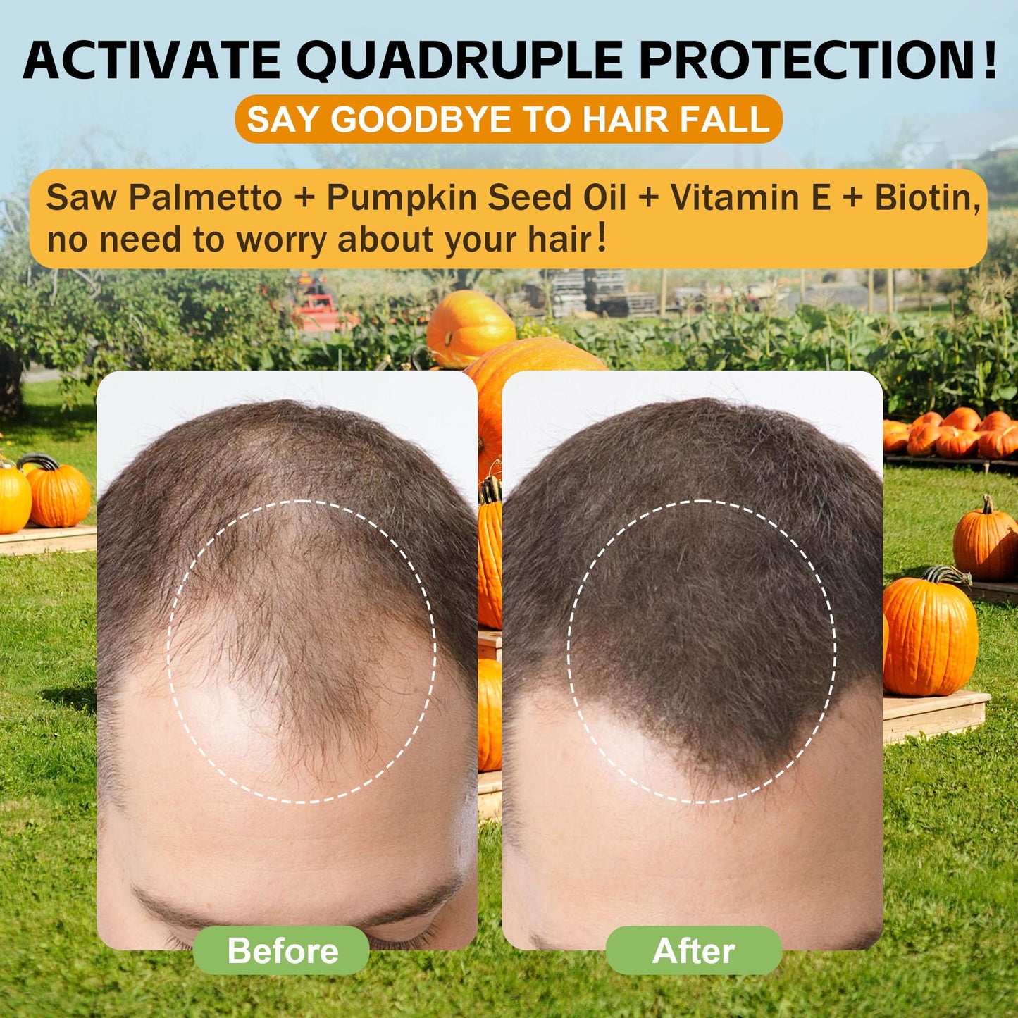Well&Whole Pumpkin Seed Oil Gummies – Hair Growth, Prostate & Urinary Support | Vegan, Sugar-Free