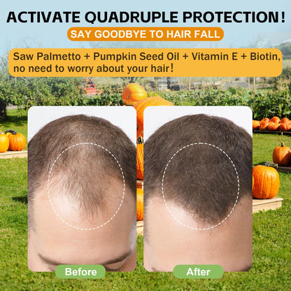 Well&Whole Pumpkin Seed Oil Gummies – Hair Growth, Prostate & Urinary Support | Vegan, Sugar-Free