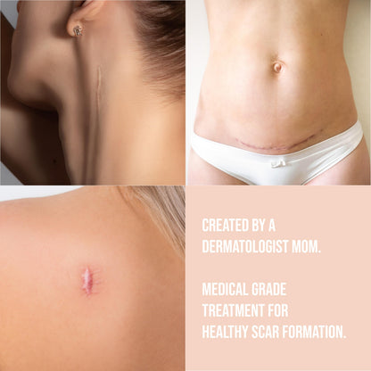 Quitch Silicone Scar Sheets for Surgical Scars | Floral 4x150cm