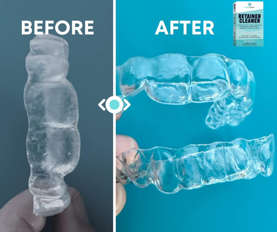 Retainer Cleaner Tablets 120 | Invisalign, Denture & Dental Appliance Cleaner - 4 Month Supply