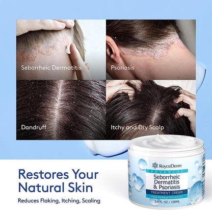 Roycederm Seborrheic Dermatitis Cream | Scalp Treatment for Psoriasis, Dandruff, Dry Scalp - 2 Pack