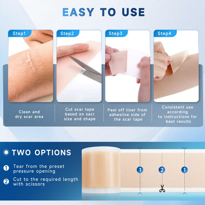 Rvlaim Silicone Scar Sheets & Tape – 3M Roll (1.6” x 120”), Surgical Scar & Stretch Mark Care