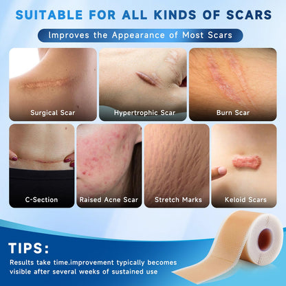 Rvlaim Silicone Scar Sheets & Tape – 3M Roll (1.6” x 120”), Surgical Scar & Stretch Mark Care