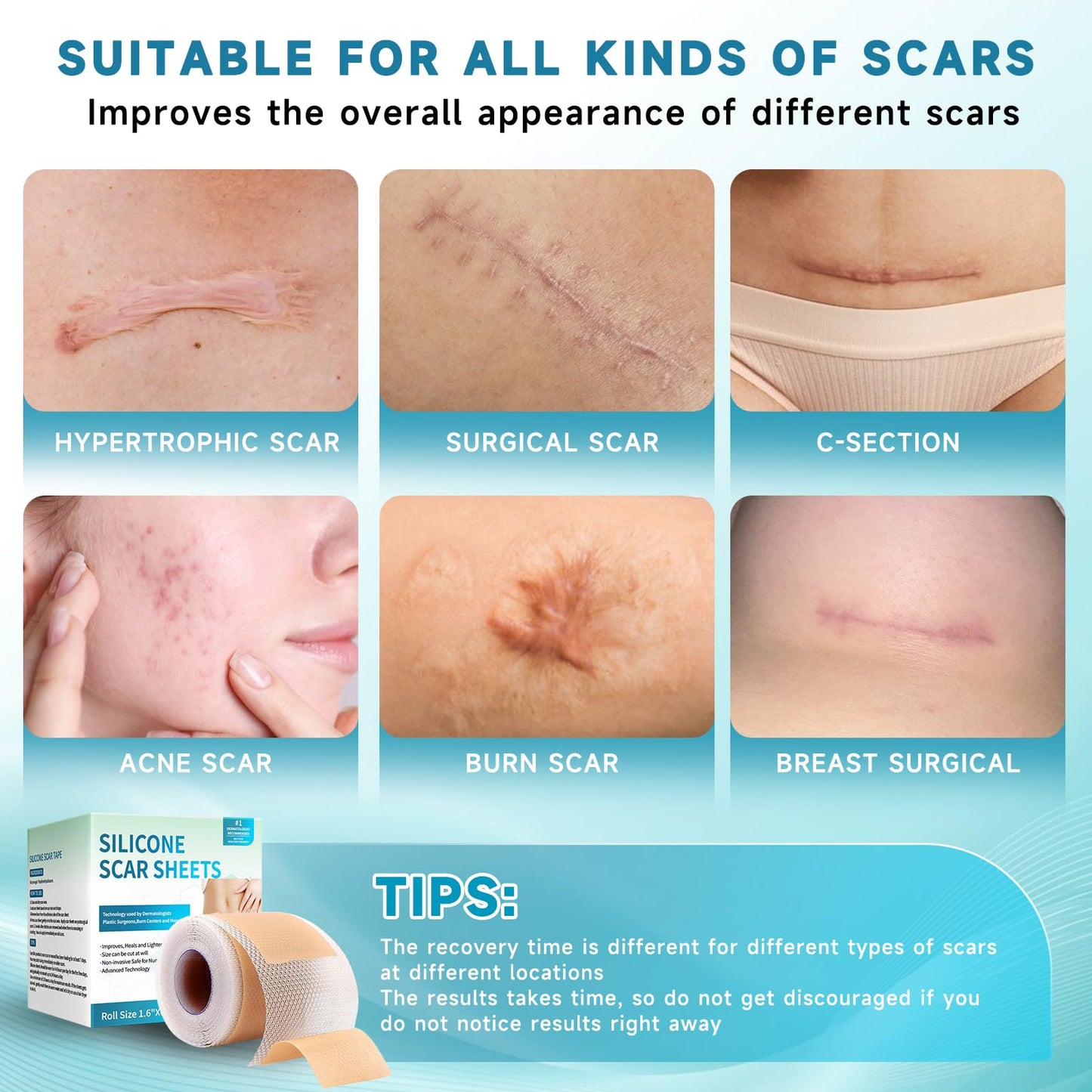 Rvlaim Silicone Scar Sheets & Tape (1.6”x60” Roll) – Gentle, Flexible Scar Care