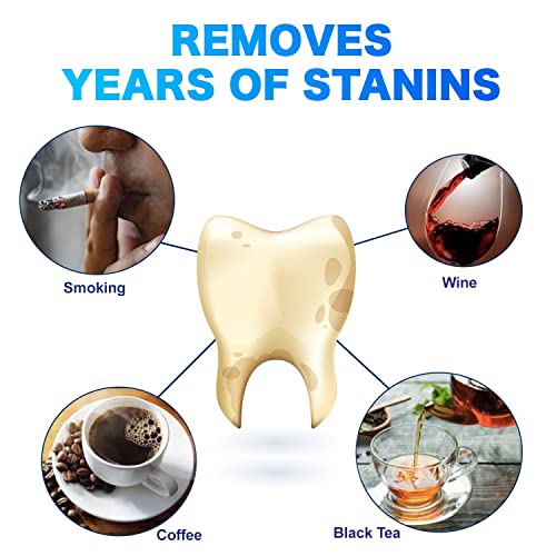 Sensitive Teeth Whitening Strips Kit – 28 PCS, 14 Treatments, Hydrogen Peroxide-Free