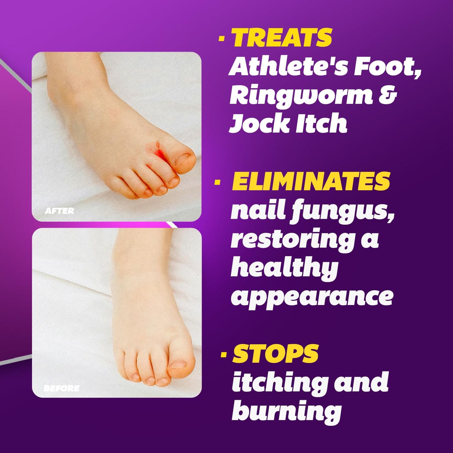 Silka Max Strength Antifungal Liquid & Cream Set – Fast Relief for Toenail Fungus, Athlete's Foot & Ringworm