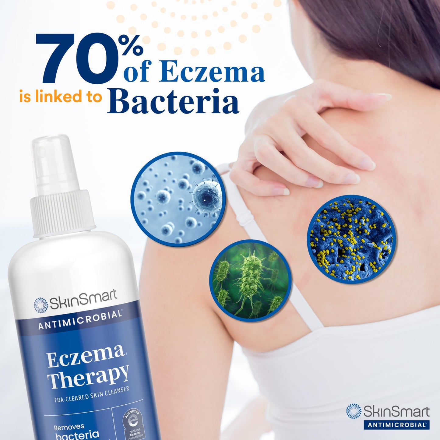 SkinSmart Antimicrobial Eczema Therapy with Hypochlorous Acid | 8 oz Clear Spray for Adults, Kids & Seniors
