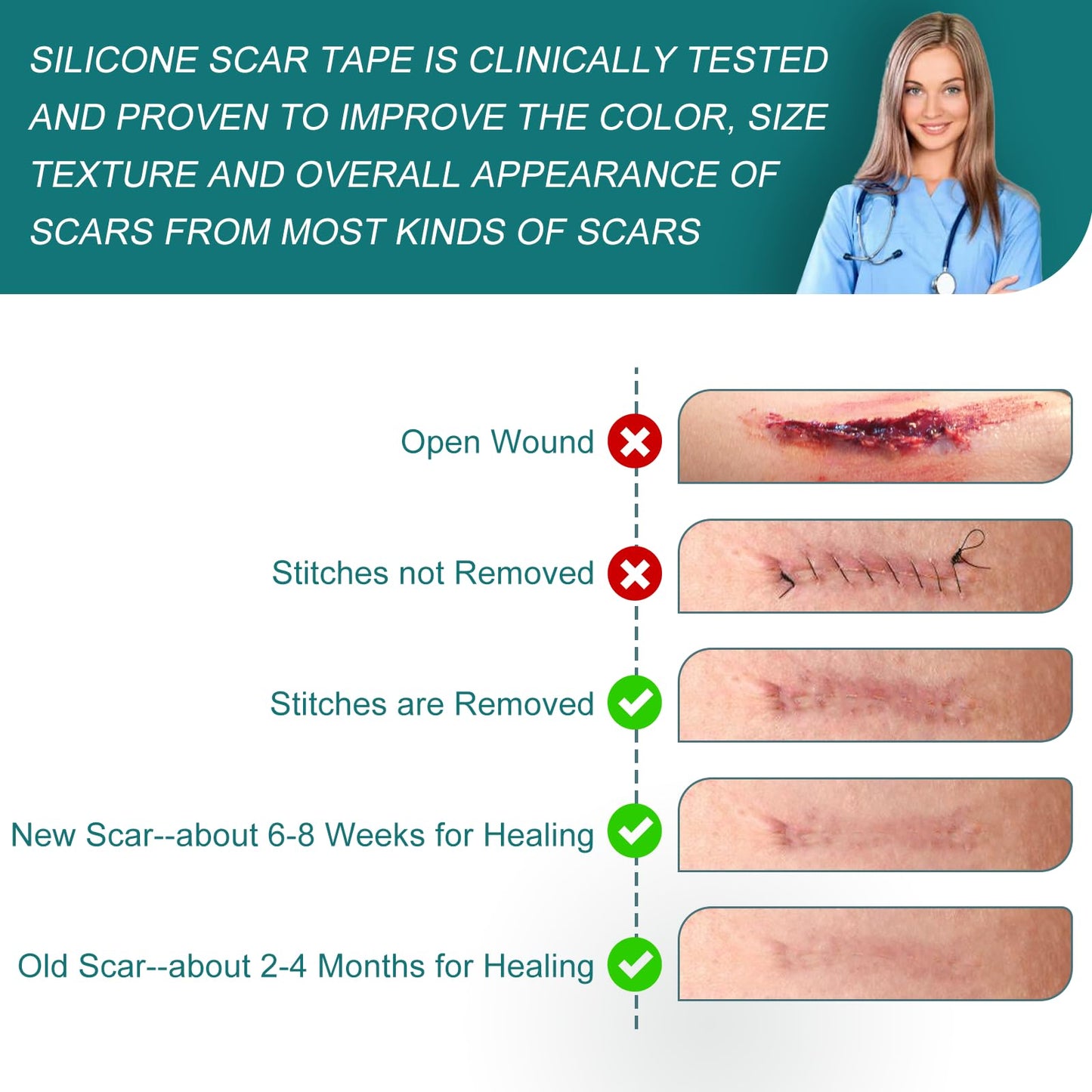 SLUKHIG Silicone Scar Sheets Roll 2M – Reusable Scar Tape for C-Section & Surgical Scars