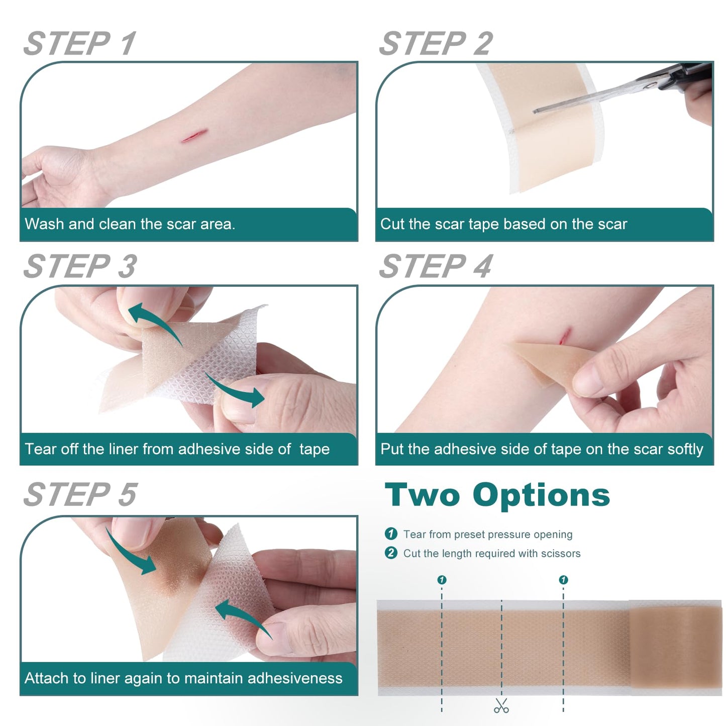 SLUKHIG Silicone Scar Sheets Roll 4M - Reusable Scar Tape for C-Section, Burns, Acne