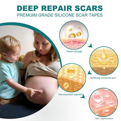 SLUKHIG Silicone Scar Sheets Roll 4M - Reusable Scar Tape for C-Section, Burns, Acne