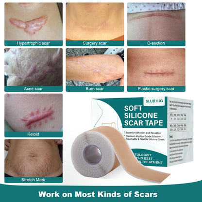 SLUKHIG Silicone Scar Sheets Roll 2M – Reusable Scar Tape for C-Section & Surgical Scars