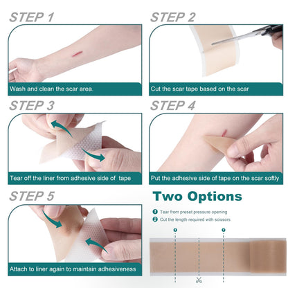 SLUKHIG Silicone Scar Sheets Roll 2M – Reusable Scar Tape for C-Section & Surgical Scars
