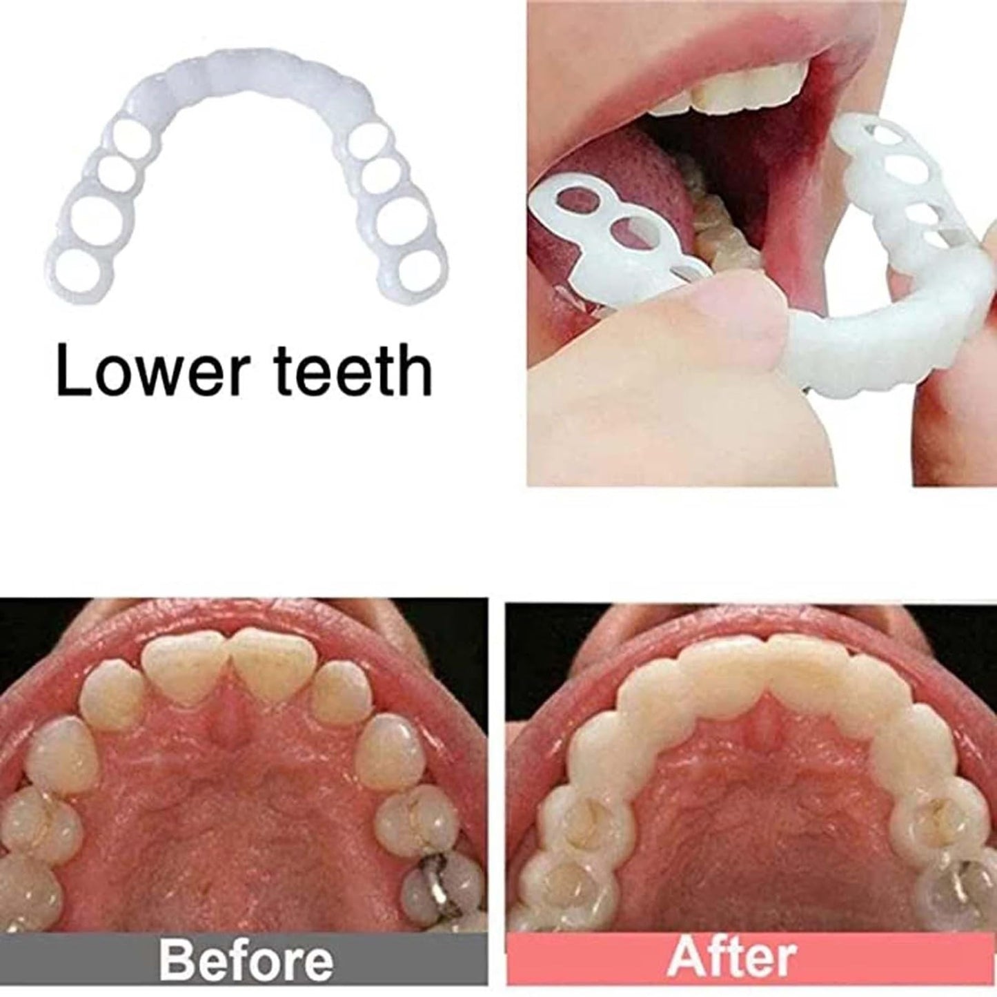 2 Pairs Temporary Adjustable Smile for Women and Men - White