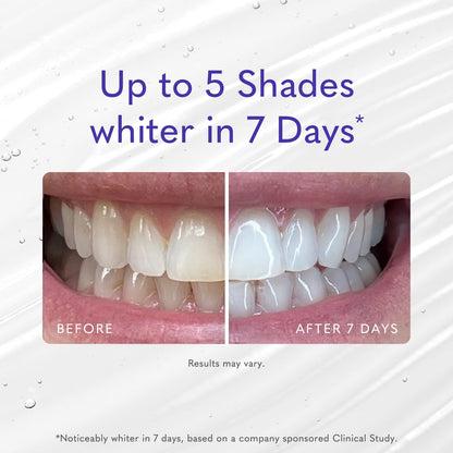 Smileactives Pro Whitening Gel for Toothpaste – 3.8 oz, Hydrogen Peroxide