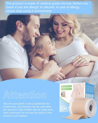 Somlzu Silicone Scar Sheets | 1.6 x 60 Inch Medical Grade Roll (1.5M)