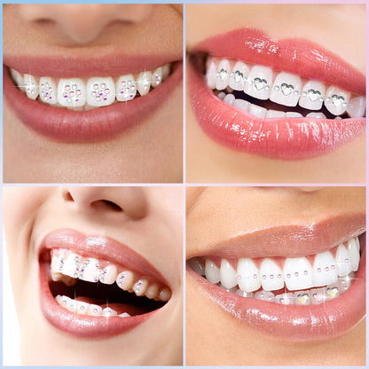 Sosation 377 Pcs 4 Shapes Tooth Gem Kit – DIY Crystal Tooth Gems for Shiny Teeth