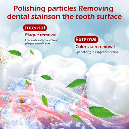 SP-6 Probiotics Whitening Toothpaste – Probiotics for Whitening, Gum Health, Enamel-Safe, Fluoride-Free