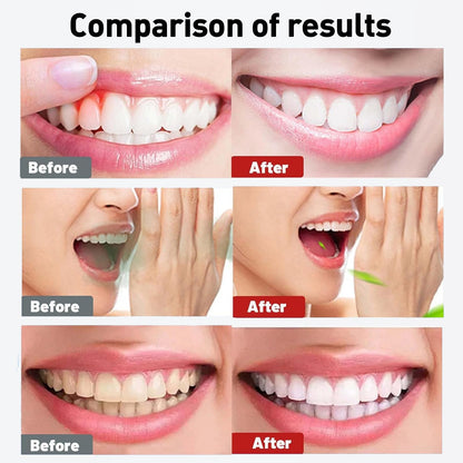 Spearmint Oil Pulling Rinse – Organic Coconut Oil & Mentha Haplocalyx, Fresh Breath & Healthy Gums, 8 fl oz