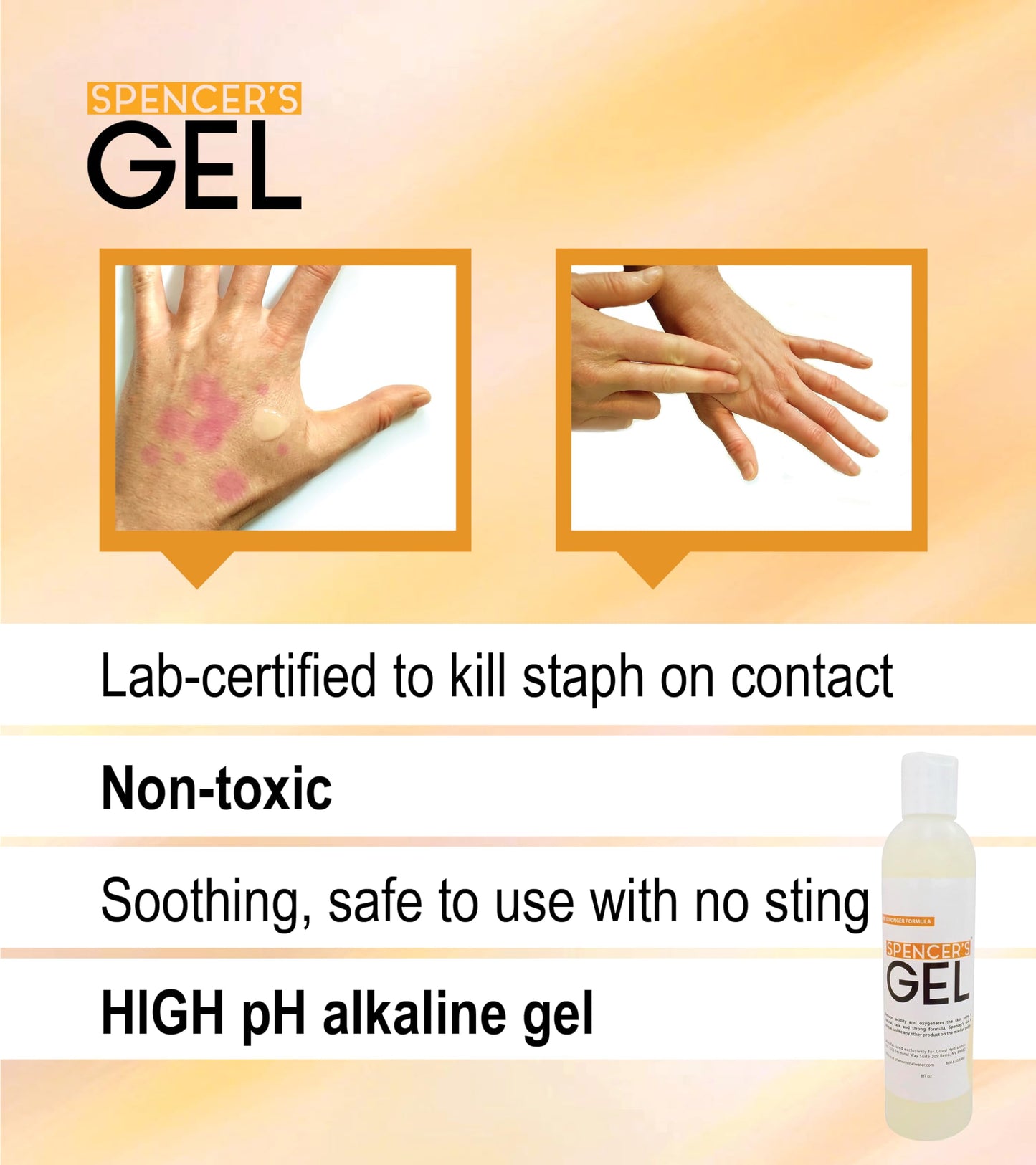 Spencer's Gel Alkaline Formula (4 oz) — High-pH Skin Care Since 2004 | Fast-Acting, Non-Stinging