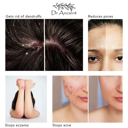Stinging Nettle Soap Bar - Organic Handmade Vegan | Dr.Ancient