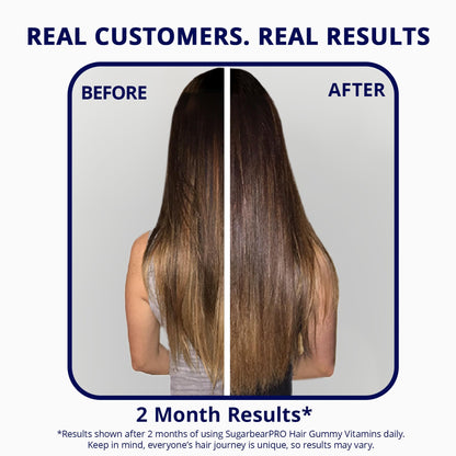 SugarBearPro Hair Vitamin Gummy – 35 Day Supply, 6000mcg Biotin, Vegan, Kosher, Halal, Cruelty-Free