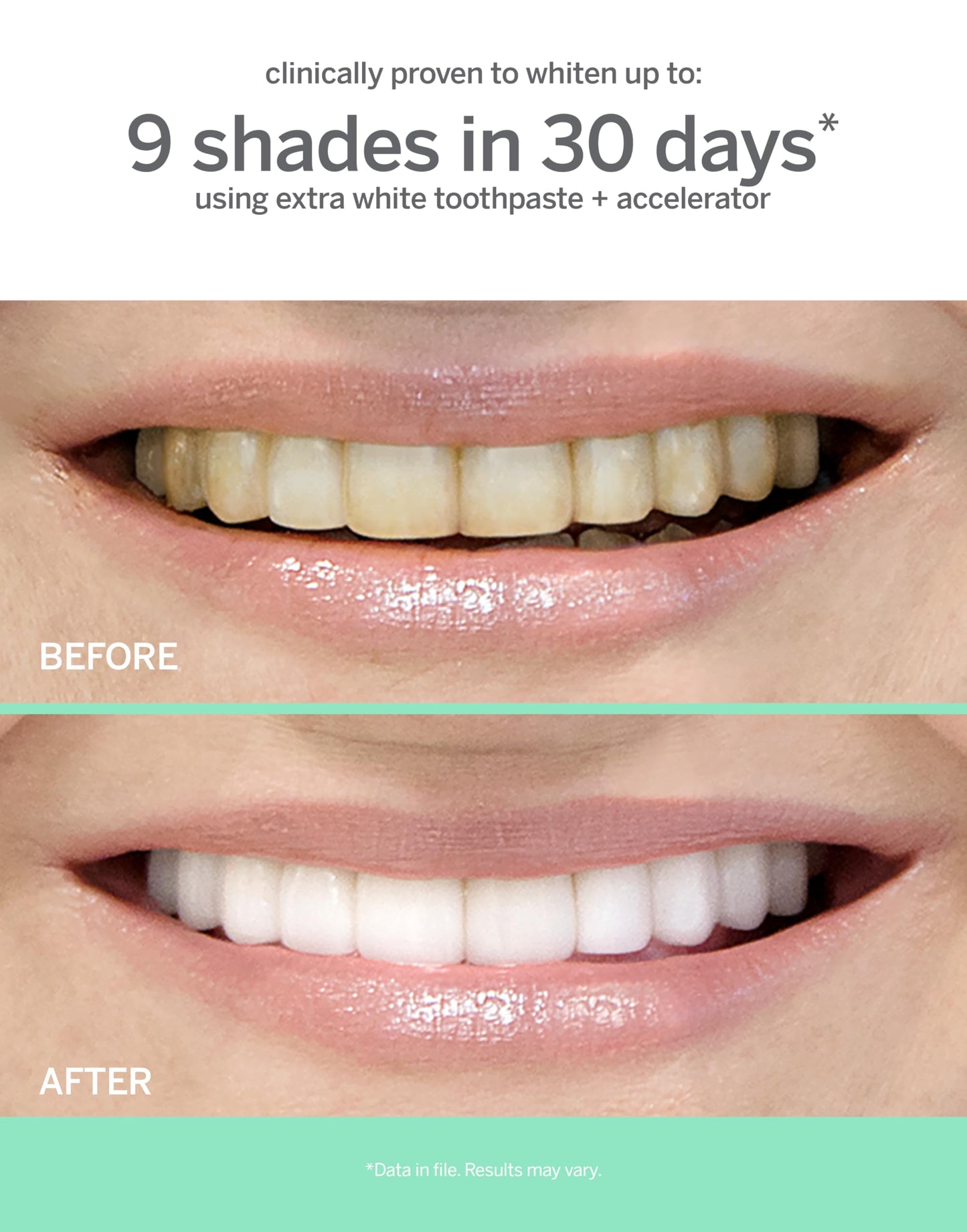 Supersmile Extra White Professional Whitening Accelerator – Enamel-Safe Teeth Whitening Gel, 7 oz