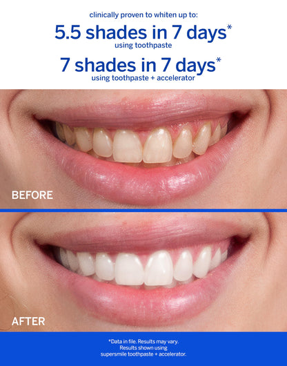 Supersmile Rosewater Mint Whitening Toothpaste with Fluoride – 8 oz | Whitens Up to 6 Shades