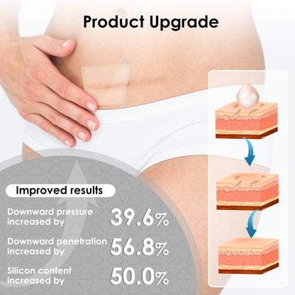 SWturK Silicone Scar Sheets Roll – Medical-Grade Scar Tape for Surgical Scars, C-Section, Tummy Tuck (1.6-in x 60-in)