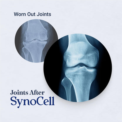 Synocell Glucosamine Chondroitin Complex 2-Pack – Joint Support with Boswellia, MSM